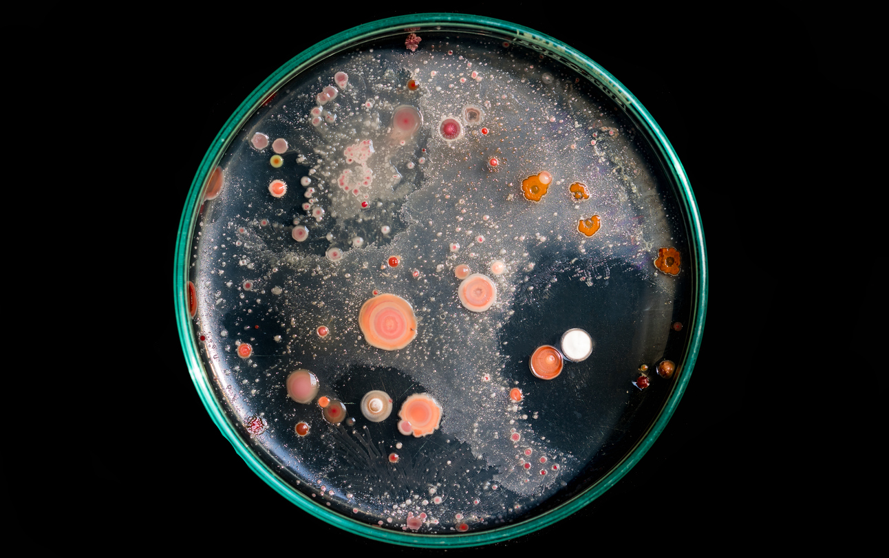 Top view soil microorganisms Nutrient agar in plate.